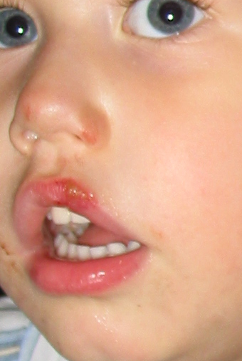 BUSTED LIP.jpg