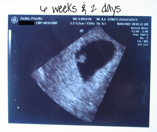 ultrasounds at 6 weeks. Ultrasound at 6 weeks and 2